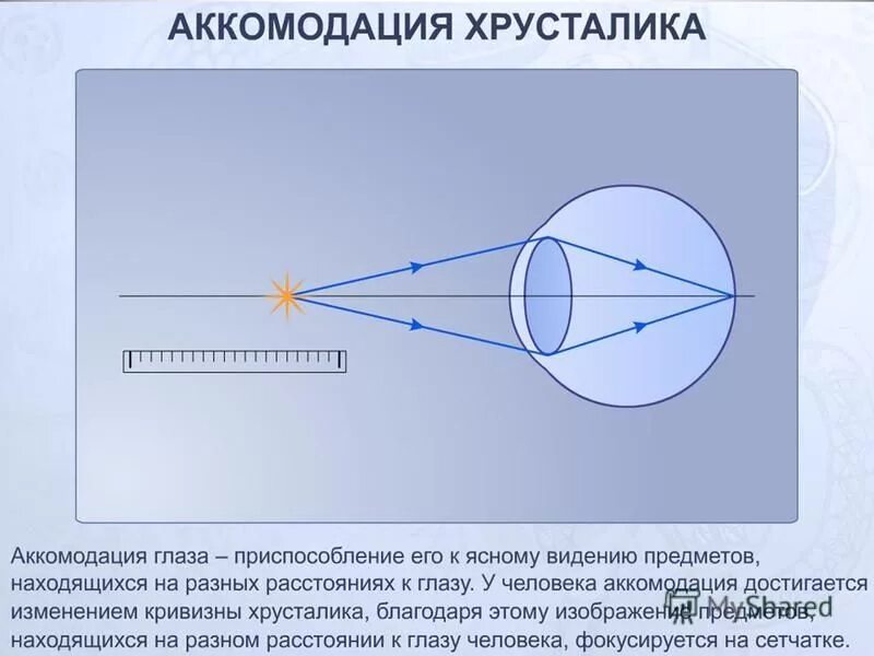 Аккомодация вблизи. Аккомодация хрусталика глаза. аккомодация глаза схема. схема аккомодации хрусталика. изменение кривизны хрусталика глаза.