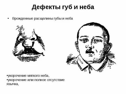 Дефекты неба