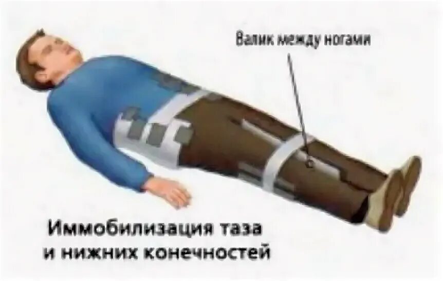 Ушиб таза код. Шаблон для презентации травма таза.