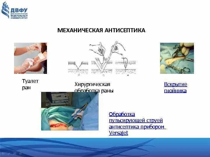 Туалет ран. Туалет ран