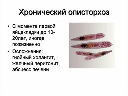 Описторхис