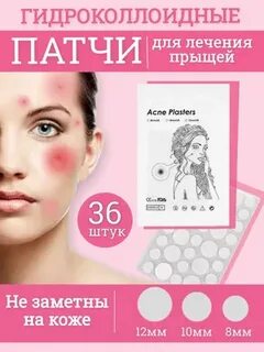 Патчи от прыщей на лице