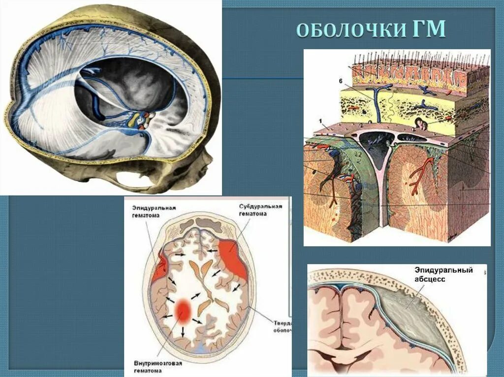 Внутренняя оболочка мозга. Оболочки ГМ. Твердая оболочка ГМ. Субарахноидальная оболочка ГМ. Оболочки ГМ И см.