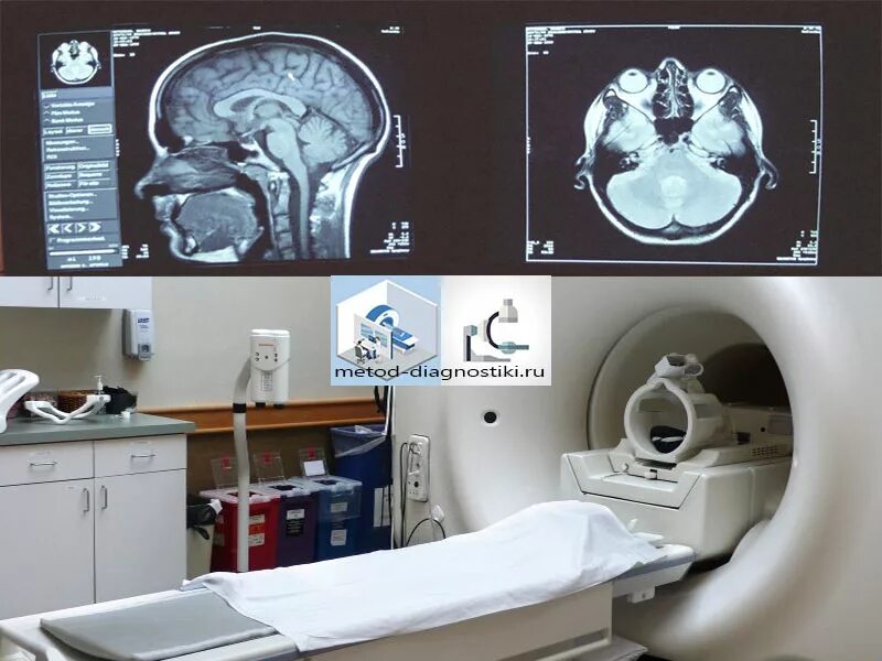 Снимок мрт головы. Магнитно резонансная томография с контрастом головного мозга. Томография снимки. Мрт с контрастом. Можно ли делать мрт с пластинами