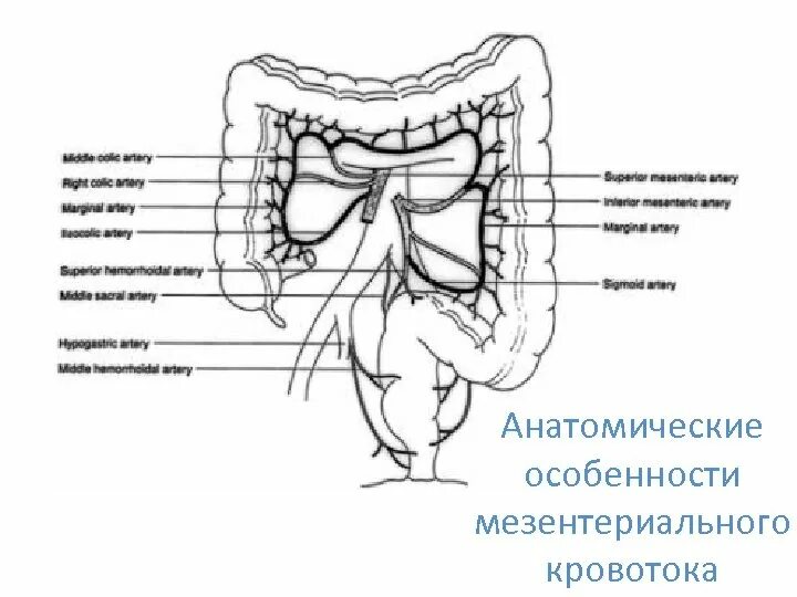 Острое мезентериальное кровообращение. Мезентериальные сосуды кт. Кт признаки мезентериального тромбоза. Тромбоз мезентериальных сосудов на кт. Нарушение мезентериального кровообращения.