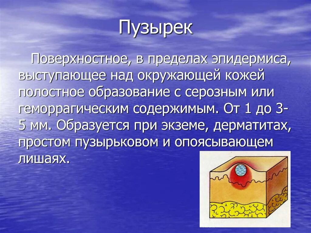 Значение слова пузырек. Везикулы с серозным содержимым. Пузырьки с геморрагическим содержимым. Волдыри с геморрагическим содержимым. Пузыри с серозно-геморрагическим содержимым.