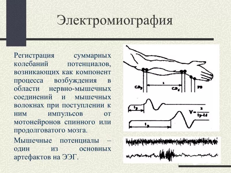 Эмг сайт