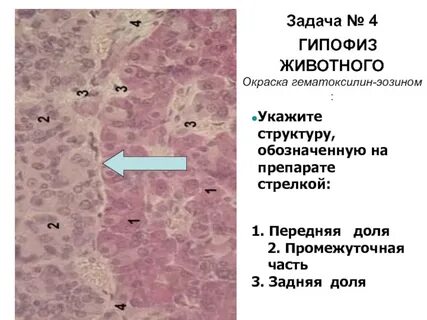 Фолликулы гипофиза