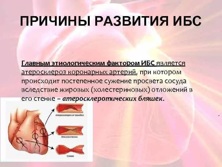 К факторам риска атеросклероза относятся тест аккредитация. Факторы риска атеросклероза. факторы риска развития атеросклероза. развитию атеросклероза и ибс способствуют:. фактор риска развития атеросклероза тест.
