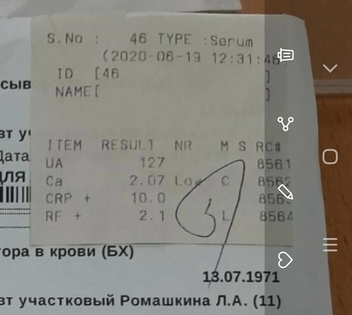 Как обозначается мочевая кислота в анализе. Как в анализах обозначается мочевая кислота. как обозначается мочевая кислота в анализе крови. мочевая кислота в крови как обозначается. мочевая кислота обозначение.