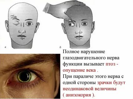 Нерв верхнего века