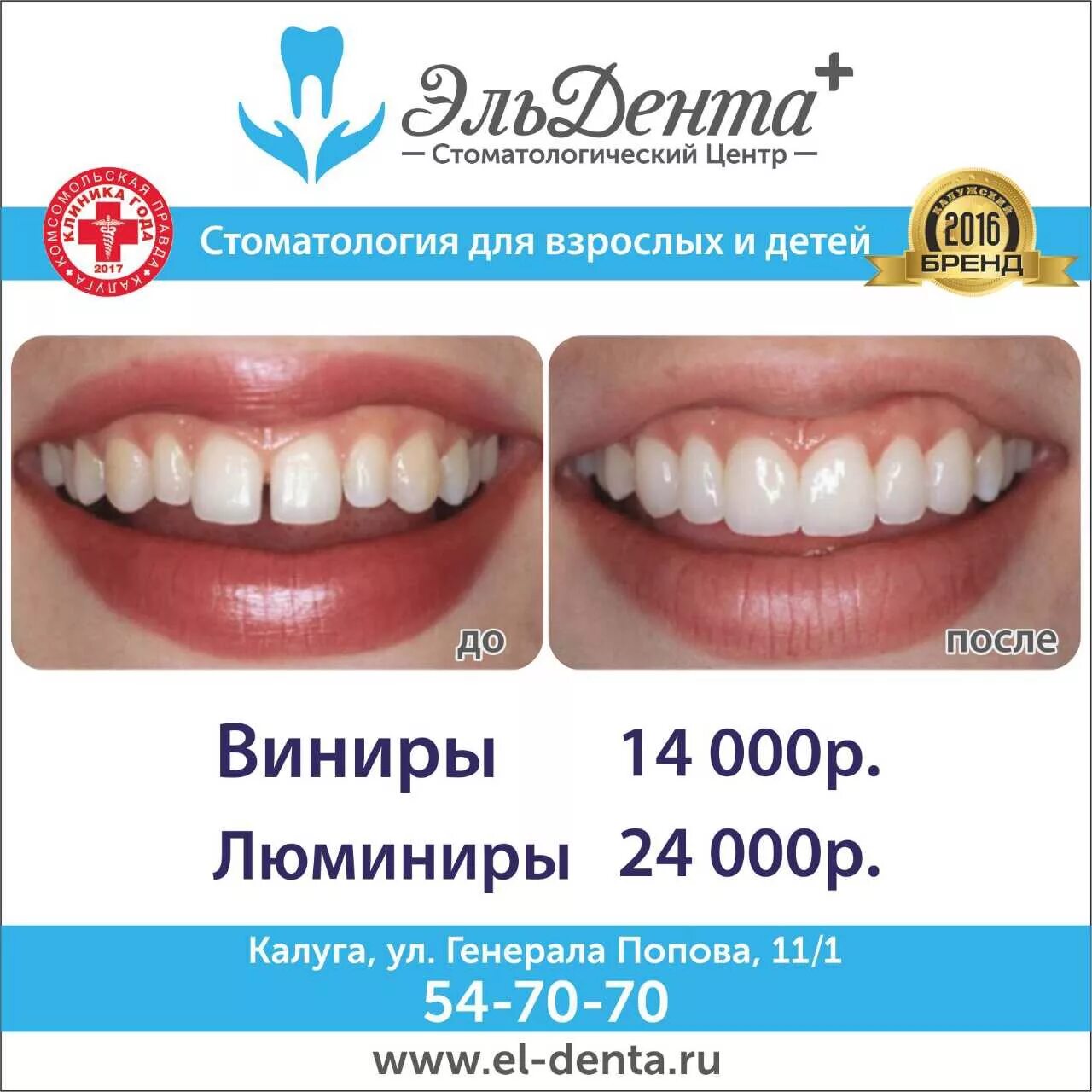 Гарантия платной пломбы