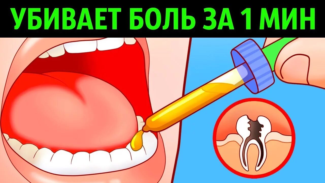 Как выдернуть болящий зуб. Методы избавления от зубной боли. зубной боли домашний условия.