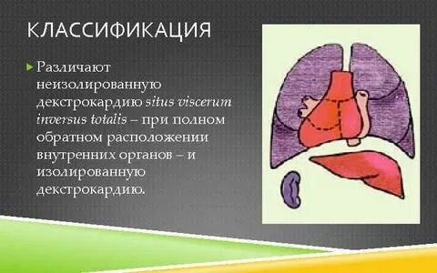 Транспозиция внутренних органов