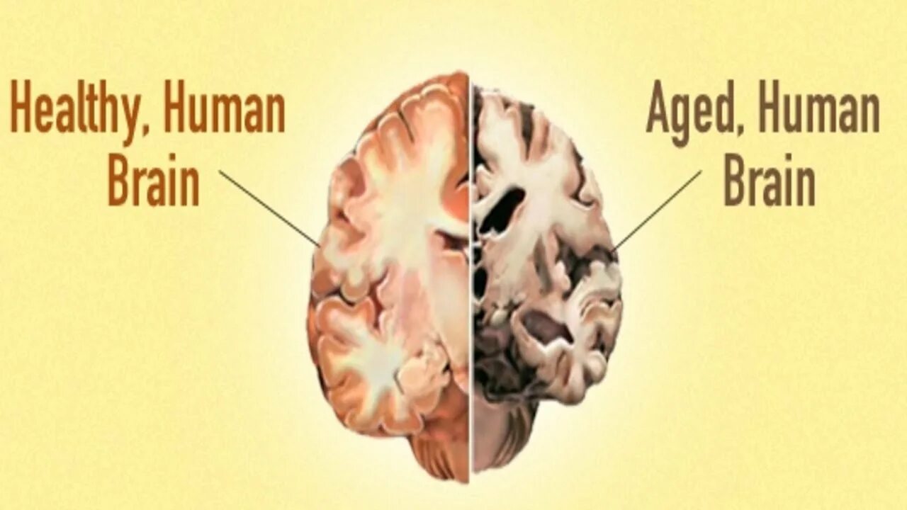Нестареющий мозг. Старение мозга. Головной мозг старость. Старение нервной системы. Мозг человека в старости.
