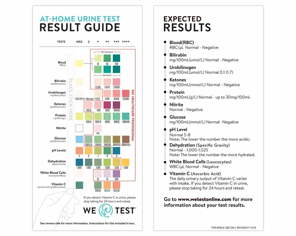 Your result тест. Urine Test Results. Urine Sample Test. Clean urine Test Cleveland. Normal urine Test.