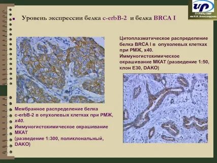 Экспрессия белков