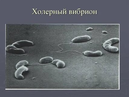 Холерный эмбрион
