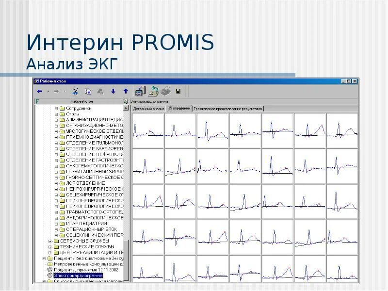 Интерин. Анализ ЭКГ. Анализ ЭКГ алгоритм. Интерин Promis. Блок схема анализа ЭКГ.