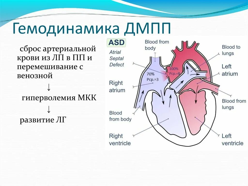 5 врожденных пороков сердца. 5 врожденных пороков сердца