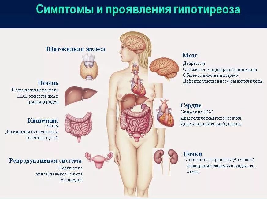 Гипотиреоз причины симптомы лечение. Гипотиреоз органы мишени. Гипотиреоз щитовидной железы. Симптомы сниженной функции щитовидной железы у женщин. Снижение функции щитовидной железы симптомы у женщин.