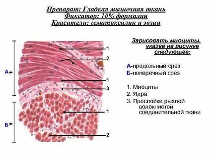 Поперечный разрез мышечной ткани