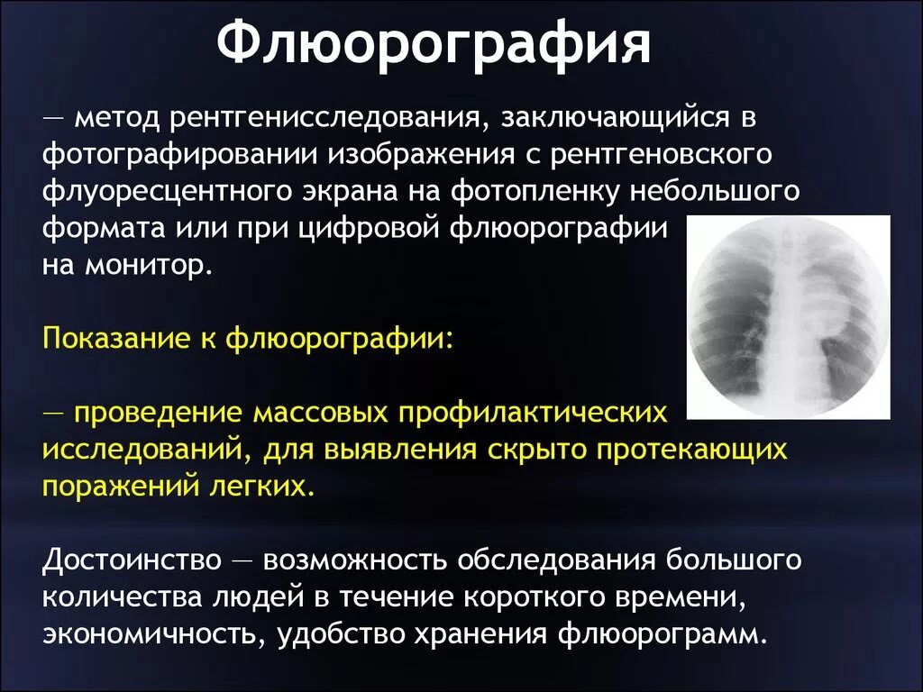 После флюорография можно можно кт делать. Флюорография. Флюорография метод исследования. Флюорография показания. Метод обследования флюорография.