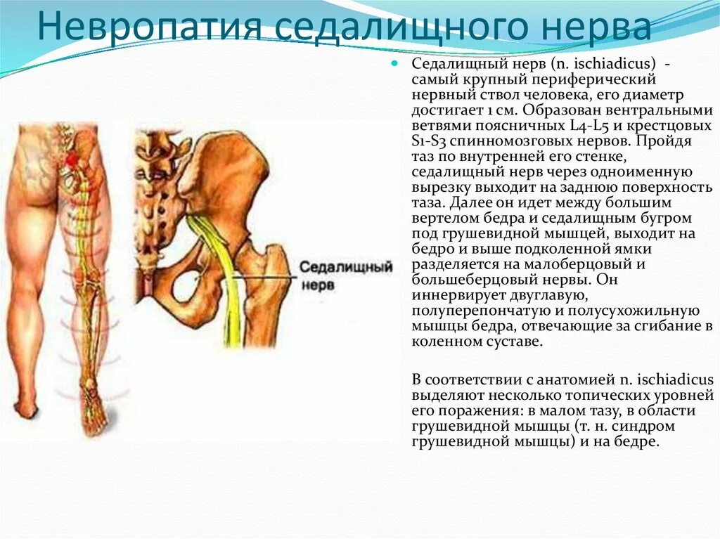 Защемило поясницу отдает в ногу. Схема защемления седалищного нерва. Седалищный нерв нерв. Точка выхода седалищного нерва. Характеристика седалищного нерва топография.