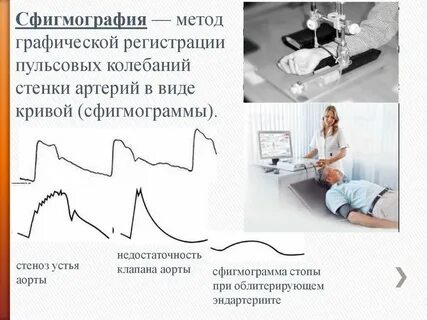 Метод реографии основан на