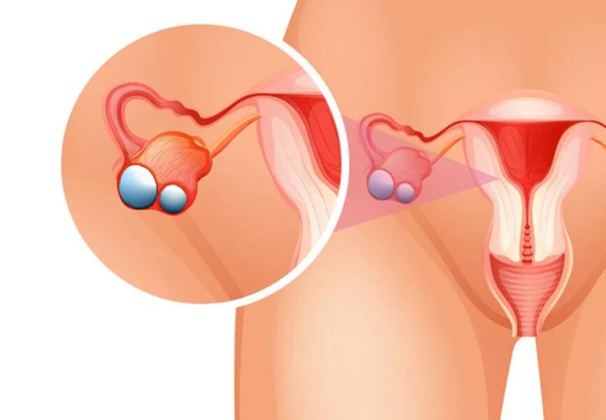 как расположены яичники у женщин