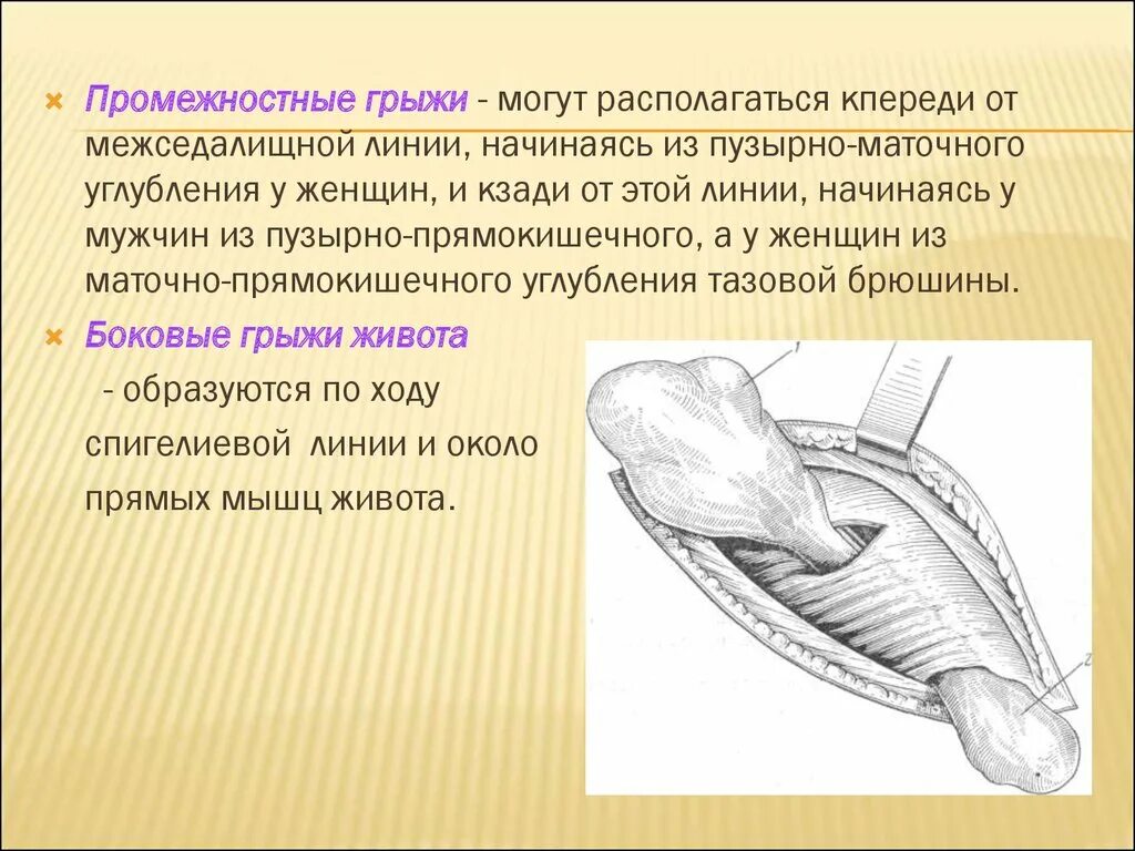 Какие есть грыжи