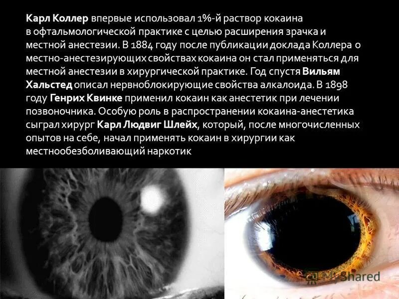 Через сколько пройдут расширенные зрачки. Расширенные зрачки от капель. Зрачки при употреблении наркотиков. Через сколько пройдут расширенные зрачки. Расширенные зрачки причины.