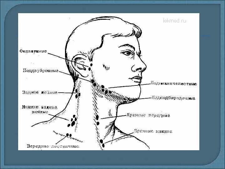 Где болит лимфоузел. Лимфоузлы на шее сбоку расположение схема. Подчелюстные лимфатические узлы схема. Схема лимфоузлов на шее человека.