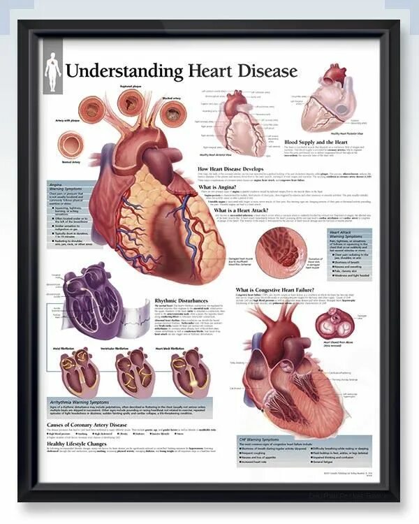 To understand a heart