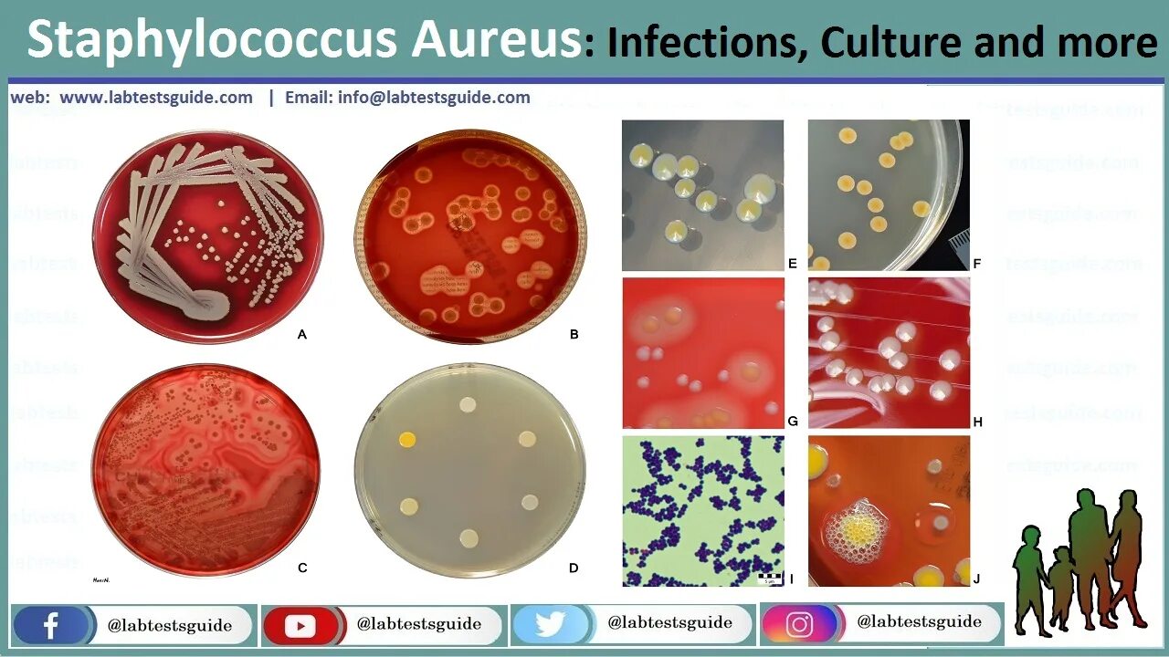 2 staphylococcus aureus