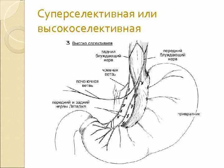 Лимфоузлы пищевода. Иннервация желудка схема. Иннервация желудка блуждающим нервом. Блуждающий нерв иннервация ЖКТ. Задний ствол блуждающего нерва.