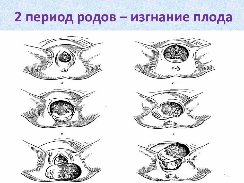 Физиологические роды презентация. Изгнание плода из полости матки. Рождение головки ребенка. Период изгнания плода при первых родах. Изгнание плода из полости матки.