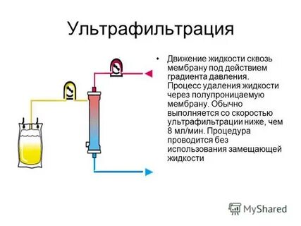 Удаление жидкости
