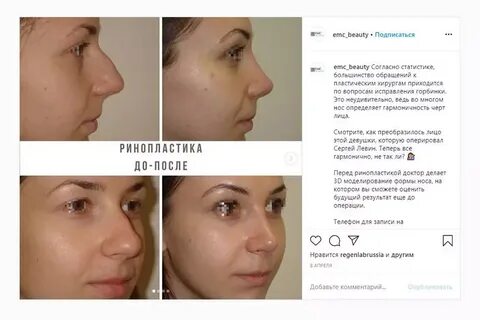 Пластика рейтинг