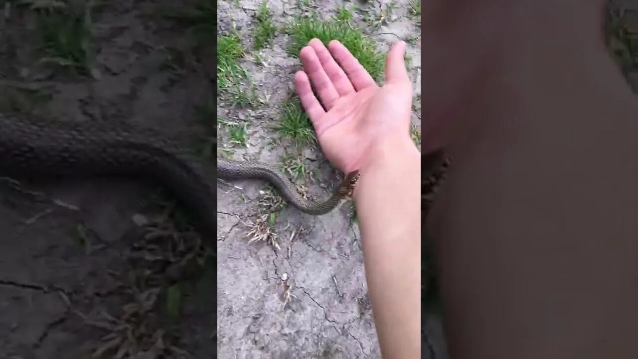 Гадюка укус человека. Укус гадюки обыкновенной. Маленькие змеи. Ядовитая змея гадюка укус. Гадюка укус человека.