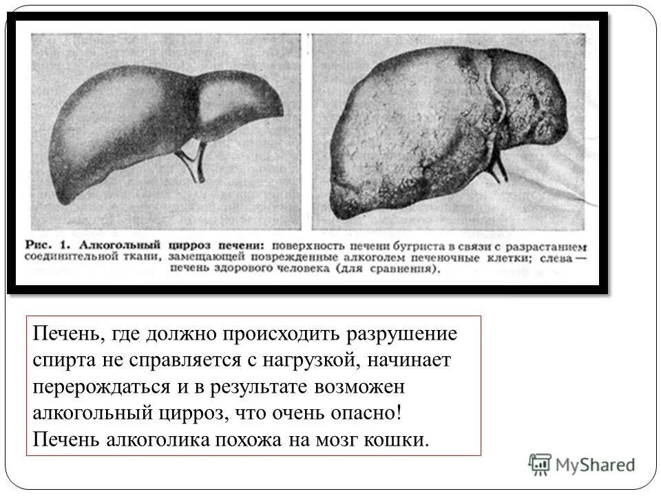 Быстрее разлагается печень песня