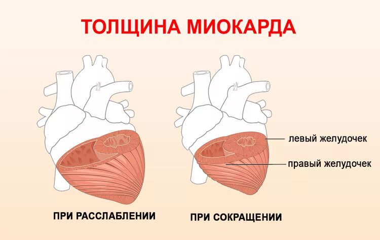 Миокард правого желудочка сердца. Толщина стенок желудочков сердца. Толщина стенок миокарда. Толщина миокарда желудочков. Миокард желудочка сердца.