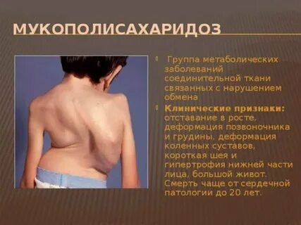 Больная спина симптомы