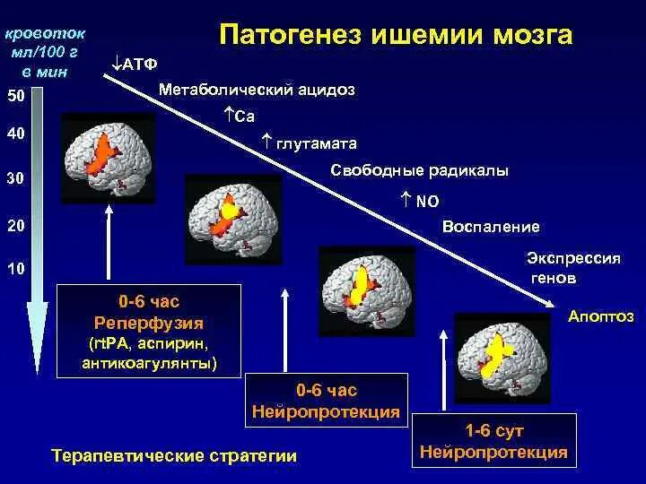 Ишемическом инсульте дают инвалидность. Патогенез ишемического инсульта схема. Этиология ишемического инсульта неврология. Механизм развития инсульта. Механизм развития ишемического инсульта.