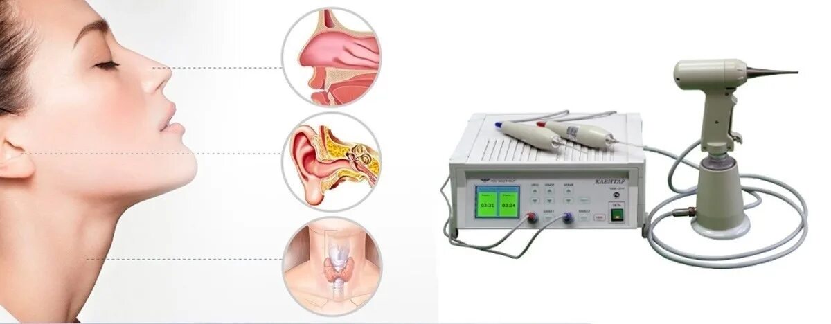 Лазер слизистой носа. Узол Кавитар. Кавитар аппарат. Кавитар ЛОР. Аппарат Матрикс ЛОР.