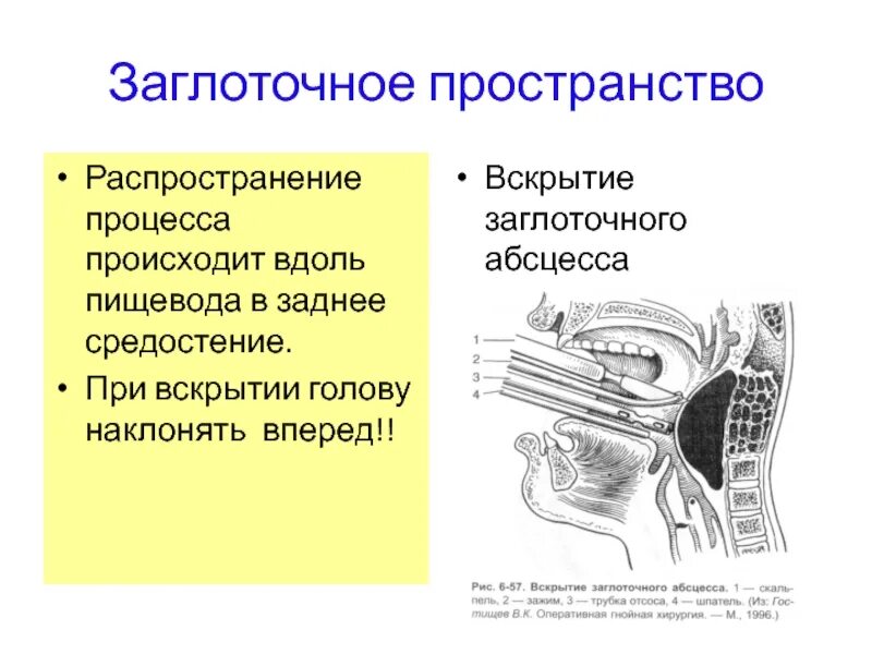 Spatium retropharyngeum. Заглоточное и окологлоточное. Заглоточное пространство шеи анатомия. Заглоточное клетчаточное пространство. Ретрофарингеальное пространство.