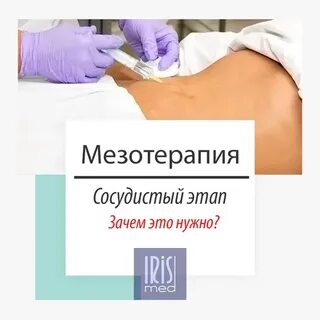 Сосудистый этап
