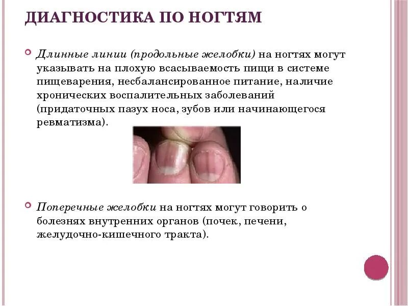 Определяем болезни по ногтям / Домоседы все для здоровья и красоты Постила