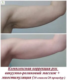 Коррекция рук