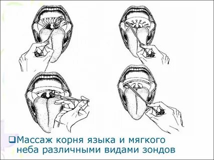 Мышцы артикуляционного аппарата